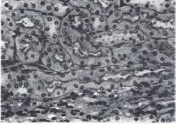 顕微鏡写真:アサイゲルマニウム投与群の腎臓組織